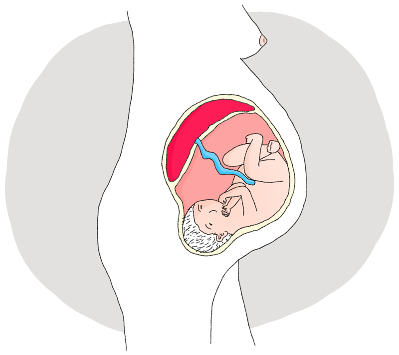 pregnancy delivery illustration - Ruth Silbermayr